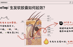 NiceTop所先养发胶囊双管齐下 从根源解决脱发难题